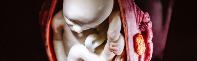 Doktoritöö: Eestist on saanud keisrilõigete osas eeskujulik põhjamaa