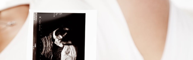 Aborditööstus muutis looteäri nimel abordiprotseduure