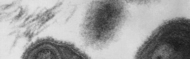 Teadlased äratasid ellu 40 000 aasta vanuse viiruse. Teoorias võib see viia uute epideemiateni