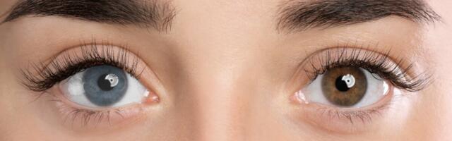 Silmavärvi muutmine on võimalik, aga mitte riskivaba