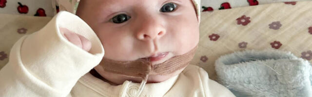 SNEZHANAT OOTAB HELSINGIS KEERULINE OPERATSIOON: AITA EMAL OLLA TEMA KÕRVAL