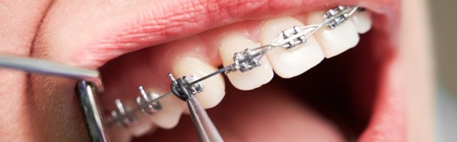 Erialaselts: ortodondiks ei saa niisama hakata