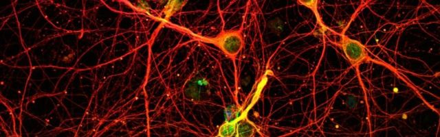 VIDEO | Vaata, kuidas aju puhastab end surnud neuronitest