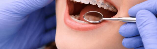 KAUNI NAERATUSE HIND | Ilusate hammaste nimel tuleb ette võtta pikk sõit