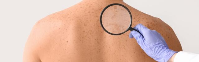 Tehisintellekti mudel näitab immuunsüsteemi aktiveeriva ravi kasutegurit