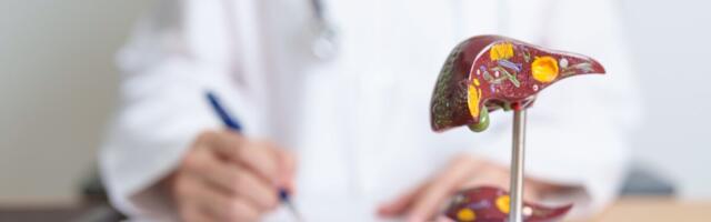 Varjatult hiiliv haigus: 70 protsenti maksavähi juhtudest avastatakse kaugelearenenud staadiumis