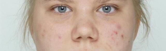 Politsei otsib 16-aastast Kärolini, keda nähti viimati Tartus