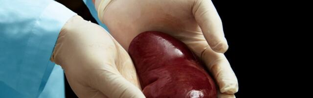 Sotsiaalse õigluse sõdalased muutsid USA neerusiirde andmebaasi järjekorda