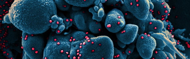 SUUR ÜLEVAADE | Uurime Eesti teadlaste abiga, kuidas koroonaviirus ründab meie rakke