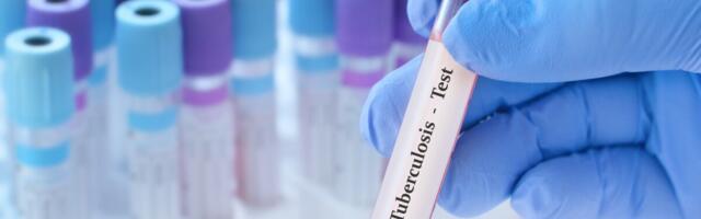 Tuberkuloos seljatas surmapõhjusena COVID-19