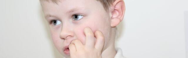 Laps närib kaelust ja küüsi, nokib naba, imeb pöialt. Kas see möödub ise või peaksid sekkuma?
