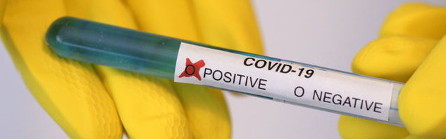 Terviseamet: ööpäevaga lisandus 42 positiivset koroonatesti, suri kaks inimest