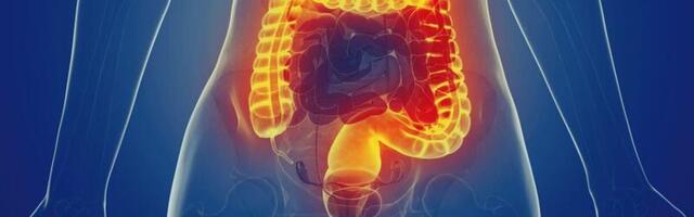 Kas põletikulisel soolehaigusel võib olla seos mikroplastiga?