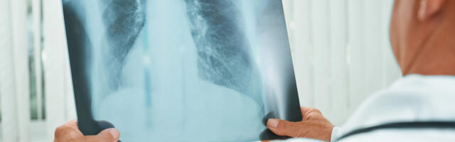 Tuberkuloosi haigestumine Eestis langeb, kuid ravimresistentsete juhtude osakaal püsib kõrge