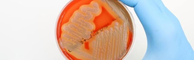 Tehisintellektiga avastatud uus antibiootikum võib võita ohtliku superbakteri