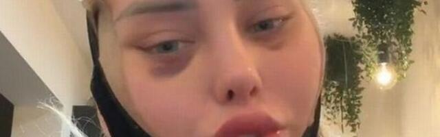 EBAMEELDIV ÜLLATUS ⟩ Naise pea plahvatas lennukis õhusurve tõttu