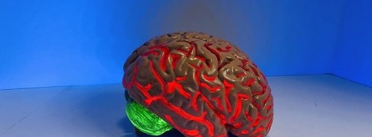 Uuring: kolmandikul koroonapatsientidest on ajus suured muutused.