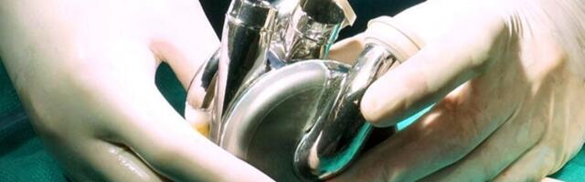 Austraalia mees, kes pidas maailmas esimesena kunstliku südamega vastu üle 100 päeva, pääses haiglast välja