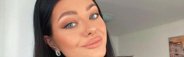 FOTO: “RANNAMAJA” SEIDI lasi oma huuled kogemata liiga suureks süstida