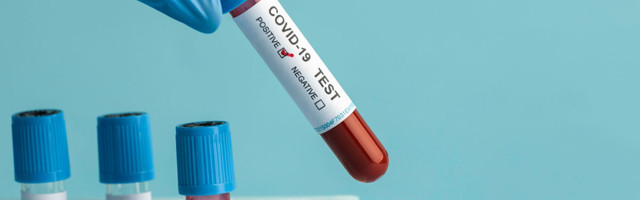 Koroonaviiruse statistika Eestis, 11. august 2021: ööpäevaga lisandus 344 positiivset