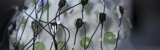 Kas surijal võib tõesti elu filmina silme eest läbi joosta?