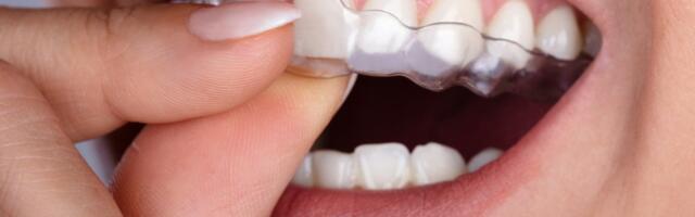 TÕHUS KAPERAVI: hambad saavad sirgeks diskreetselt ja valutult