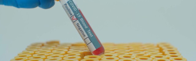 Reporter: Õpetajate vaktsineerimine üllatas suure puudujate arvuga