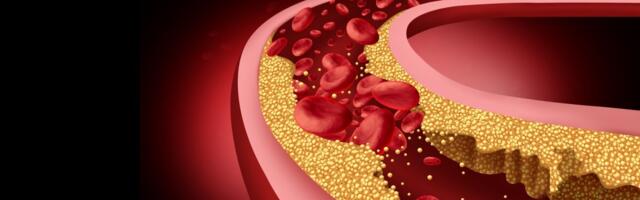 Doktoritöö: visfatiini mõõtmine võib ennetada diabeedipatsientide arterite lupjumist