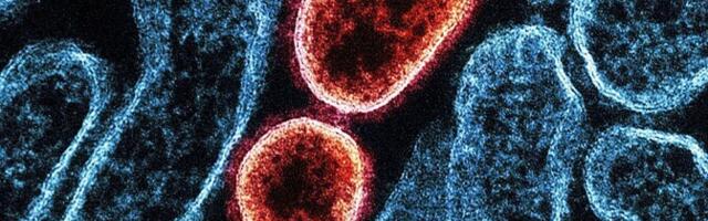 Lutsar: Nipah' viirus ilmselt uut pandeemiat ei põhjusta