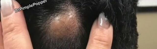 Mees arvas, et ta peas on muhk, kuid tegelikult...