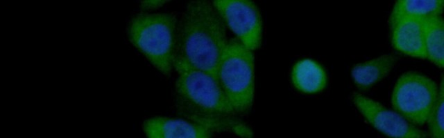 Teadlased on astunud taas sammu lähemale koroona müsteeriumi mõistmisele: just see ensüüm mõjutab seda, kui raskelt me haigestume