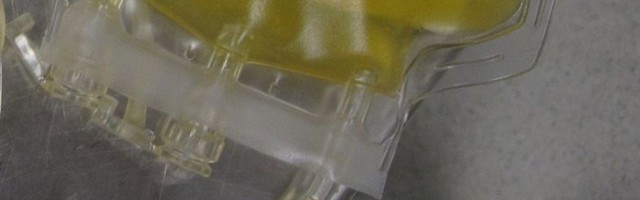 COVID-19-st tervenenute vereplasma ootab külmikutes õigeid patsiente