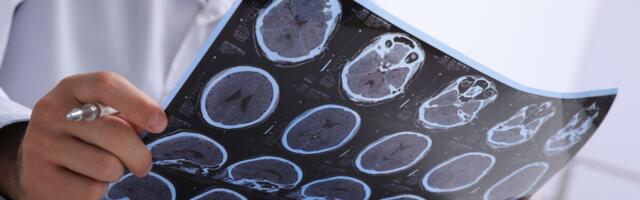 Roche: Sõda Ukrainas võib hakata takistama hulgiskleroosi ravimite arendust