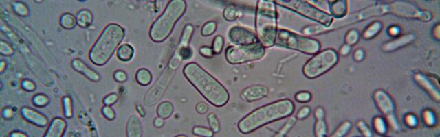 Legionella bakter tekitab küsimusi - kas spaade ja spordiklubide külastamine on ikka ohutu?