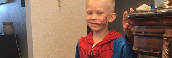 Avaldati uued detailid õe koerarünnakust päästnud intsidendi kohta: kui koer poissu põsest hammustas, hõikas ta, et õde ära jookseks