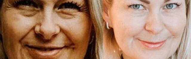 ENNE JA PÄRAST FOTOD: vaata, mida Marju Karini ilusüstid blogija Mari-Leen Albersi näoga tegid