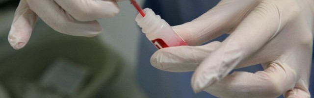 Testimisnädal kutsub kahtlejaid HIV-testi tegema