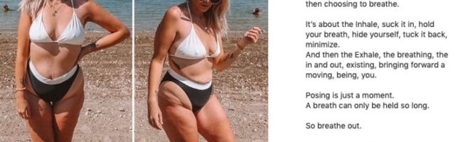FOTOD | Julge ja inspireeriv! Üks ema otsustas näidata, milline ta tagumikku kattev nahk tegelikult on, sest milleks seda häbeneda?