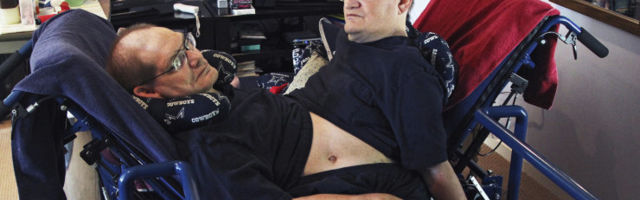 Maailma kõige ebatavalisemad kaksikud surid 68-aastastena