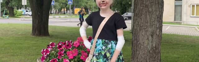 Palun ulata abikäsi 10-aastasele üliharuldast haigust põdevale Cassandrale!