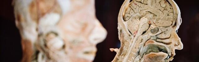 Alzheimeri sümptomite algust võib tulevikus ennustada vereanalüüsiga