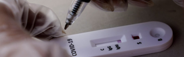 Koroona-antikehatestide võrdlus paljastas liiga optimistlikud lubadused