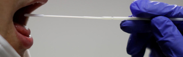 Sülg võib olla usaldusväärne alternatiiv ninaneelu proovile SARS-CoV-2 tuvastamiseks