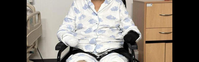 Hoiatav juhtum: naine kaotas kõik oma jäsemed pärast seda, kui lasi neid koeral lakkuda