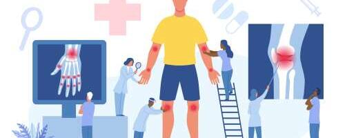 Uuring: oled reumaatilise haiguse patsient? Sulle on küsimusi!