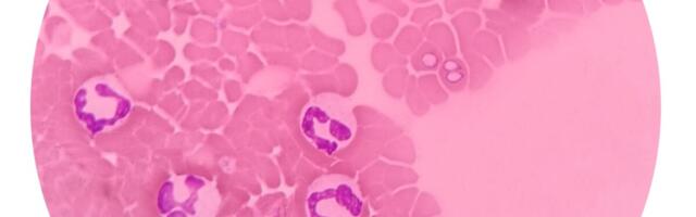 Puukide levitatavate haiguste hulka on lisandunud uus tõbi