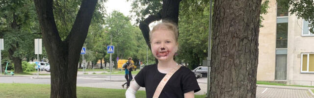 ANNETAJATE ABI VAJAV CASSANDRA PÕEB EESTIS AINSANA ÜLIHARULDAST NAHAHAIGUST