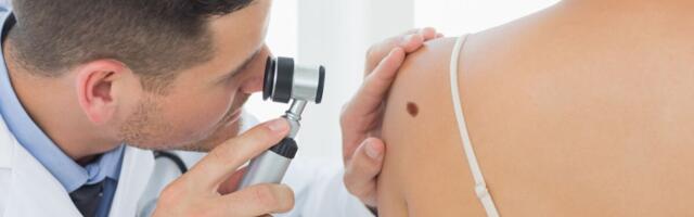 Geneetiliselt muundatud herpesviirus võib melanoomi ravi parandada