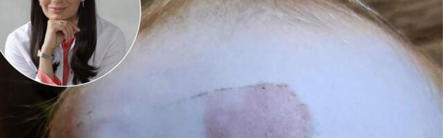 „Plaastrist tekkinud jälg püsis lapse otsaees ligi kuu.“ Kuidas vältida ja ravida plaastrist tekkivat ärritust?