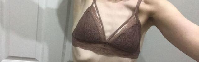 Kas teadsid, et aevastades võib ribi murda?